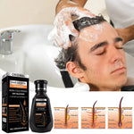 Hair Growth Shampoo (HGS-01)